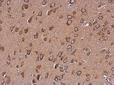 Immunohistochemistry-Paraffin: WDR16 Antibody [NBP2-20889] - Immunohistochemical analysis of paraffin-embedded CL1-5 xenograft, using antibody at 1:500 dilution.