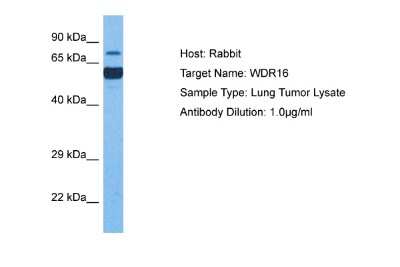 Western Blot: WDR16 Antibody [NBP2-88588] - Host: Rabbit. Target Name: WDR16. Sample Tissue: Lung Tumor lysates. Antibody Dilution: 1ug/ml