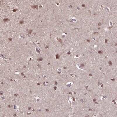 Immunohistochemistry-Paraffin WDR17 Antibody - BSA Free