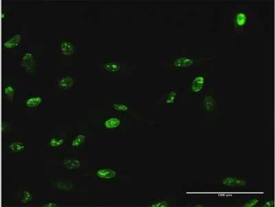Immunocytochemistry/Immunofluorescence: WDR18 Antibody [H00057418-B01P] - Analysis of purified antibody to WDR18 on HeLa cell. (antibody concentration 10 ug/ml)