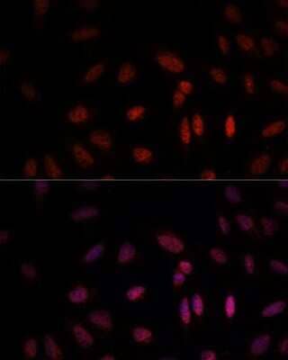 Immunocytochemistry/Immunofluorescence: WDR18 Antibody [NBP2-93719] - Analysis of U-2 OS cells using WDR18 at dilution of 1:100. Blue: DAPI for nuclear staining.