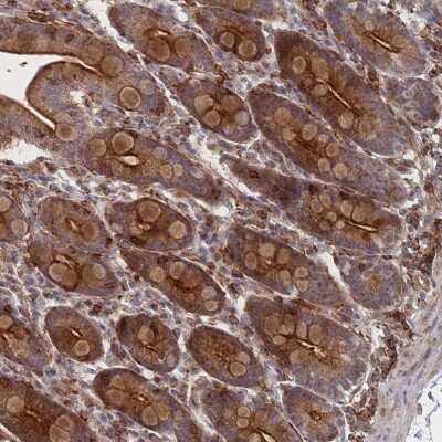 <b>Independent Antibodies Validation. </b>Immunohistochemistry: WDR18 Antibody [NBP2-30528] - Staining of human duodenum shows strong cytoplasmic and membranous positivity in glandular cells.