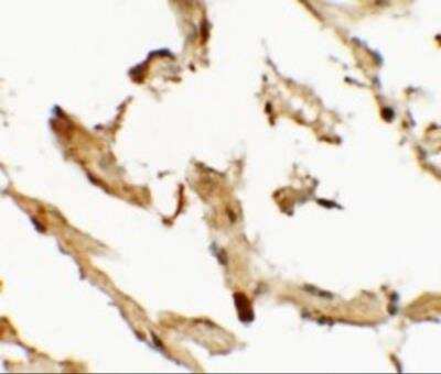 Immunohistochemistry: WDR18 Antibody [NBP2-81877] - Immunohistochemistry of WDR18 in human lung tissue with WDR18 antibody at 2.5 ug/mL.