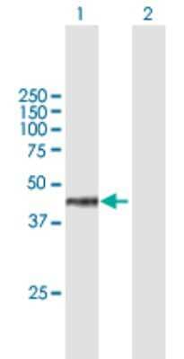 Western Blot: WDR18 Antibody [H00057418-B01P] - Analysis of WDR18 expression in transfected 293T cell line by WDR18 polyclonal antibody.  Lane 1: WDR18 transfected lysate(47.52 KDa). Lane 2: Non-transfected lysate.