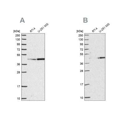 Western Blot: WDR18 Antibody [NBP2-30528] - Analysis using Anti-WDR18 antibody NBP2-30528 (A) shows similar pattern to independent antibody NBP2-30928 (B).