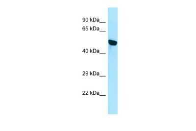 Western Blot: WDR18 Antibody [NBP2-88589] - WB Suggested Anti-WDR18 Antibody. Titration: 1.0 ug/ml. Positive Control: Jurkat Whole CellWDR18 is supported by BioGPS gene expression data to be expressed in Jurkat