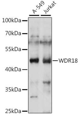 Western Blot: WDR18 Antibody [NBP2-93719] - Analysis of extracts of various cell lines, using WDR18 at 1:1000 dilution. Secondary antibody: HRP Goat Anti-Rabbit IgG (H+L) at 1:10000 dilution. Lysates/proteins: 25ug per lane. Blocking buffer: 3% nonfat dry milk in TBST. Detection: ECL Basic Kit . Exposure time: 120s.