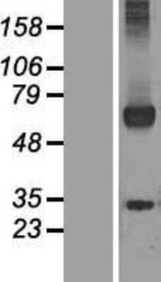 Western Blot WDR20 Overexpression Lysate