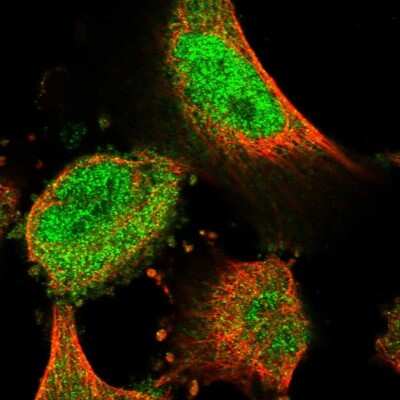 Immunocytochemistry/Immunofluorescence: WDR26 Antibody [NBP1-83628] - Staining of human cell line U-251 MG shows localization to nucleoplasm & cytosol. Antibody staining is shown in green.