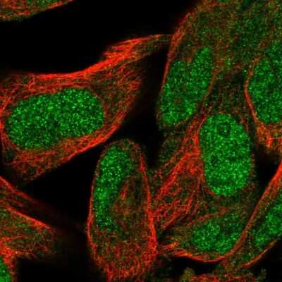 Immunocytochemistry/Immunofluorescence: WDR26 Antibody [NBP2-56688] - Staining of human cell line RH-30 shows localization to nucleoplasm & cytosol.