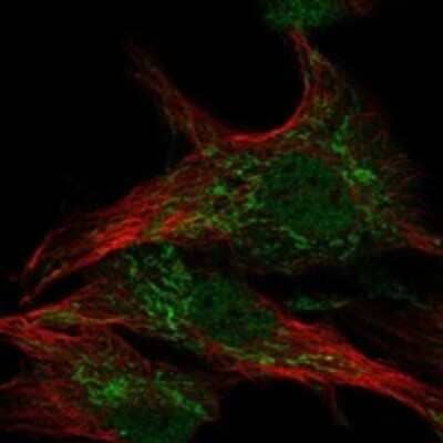 Immunocytochemistry/Immunofluorescence: WDR26 Antibody [NBP3-17963] - Staining of human cell line hTERT-RPE1 shows localization to nucleoplasm & mitochondria.