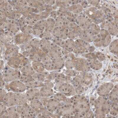 Immunohistochemistry-Paraffin WDR26 Antibody