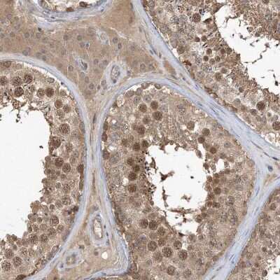 Immunohistochemistry-Paraffin: WDR26 Antibody [NBP1-83628] - Staining of human testis shows high expression.