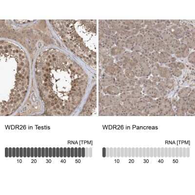 Immunohistochemistry-Paraffin WDR26 Antibody