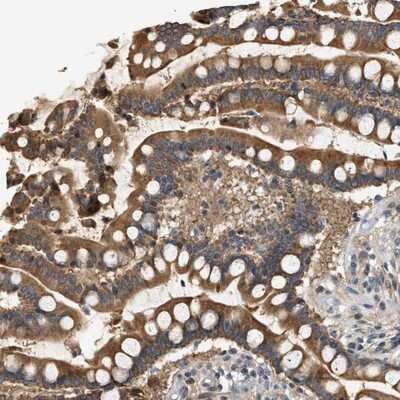 Immunohistochemistry-Paraffin: WDR31 Antibody [NBP1-81962] - Staining of human colon shows strong cytoplasmic positivity in glandular cells.