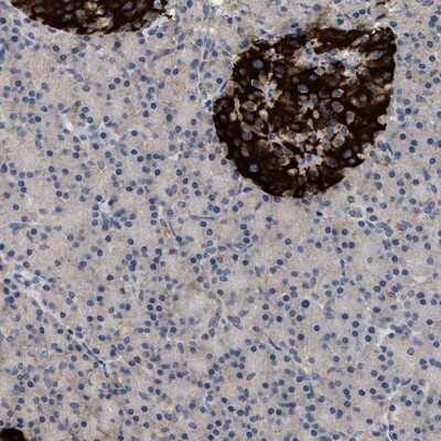 Immunohistochemistry-Paraffin WDR31 Antibody - BSA Free