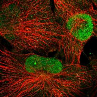 Immunocytochemistry/Immunofluorescence: WDR33 Antibody [NBP2-58189] - Staining of human cell line U-251 MG shows localization to nucleoplasm & nucleoli fibrillar center.