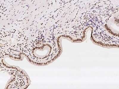 Immunohistochemistry-Paraffin: WDR33 Antibody [NBP2-97871] - Immunochemical staining of human WDR33 in human gallbladder with rabbit polyclonal antibody at 1:100 dilution, formalin-fixed paraffin embedded sections.