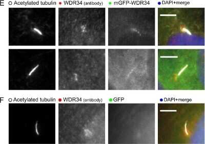 Immunocytochemistry/Immunofluorescence: WDR34 Antibody [NBP1-88805] - Localization of mGFP-WDR34. Cells expressing mGFP-WDR34 were fixed with paraformaldehyde and labeled to detect acetylated tubulin and WDR34, as indicated. Two examples are shown. Cells expressing GFP were processed as in E to demonstrate an absence of GFP from primary cilia. Scale bars: 5 um. Image collected and cropped by CiteAb from the following publication (//jcs.biologists.org/cgi/doi/10.1242/jcs.159038), licensed under a CC-BY license.