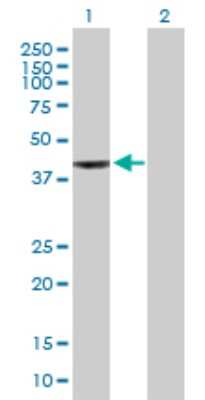Western Blot: WDR34 Antibody [H00089891-B01P] - Analysis of WDR34 expression in transfected 293T cell line by WDR34 polyclonal antibody.  Lane 1: WDR34 transfected lysate(46.09 KDa). Lane 2: Non-transfected lysate.