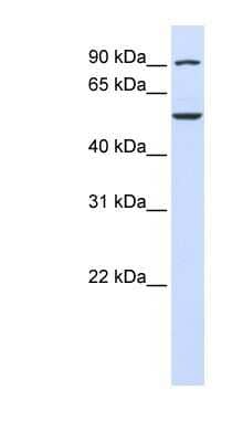 Western Blot: WDR34 Antibody [NBP1-55268] - Titration: 0.2-1 ug/ml, Positive Control: Human brain.