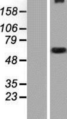 Western Blot: WDR34 Overexpression Lysate (Adult Normal) [NBP2-05859] Left-Empty vector transfected control cell lysate (HEK293 cell lysate); Right -Over-expression Lysate for WDR34.