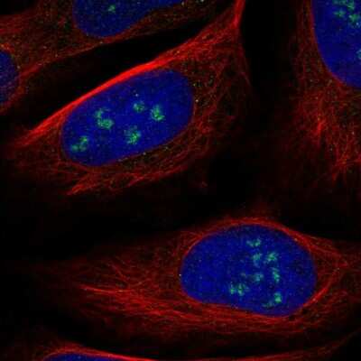 Immunocytochemistry/Immunofluorescence: WDR36 Antibody [NBP2-38364] - Immunofluorescent staining of human cell line U-2 OS shows localization to nucleoli.