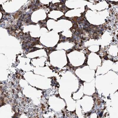 Immunohistochemistry: WDR36 Antibody [NBP2-38364] - Staining of human bone marrow shows strong cytoplasmic positivity in hematopoietic cells.