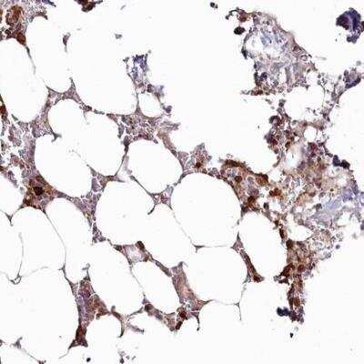 Immunohistochemistry-Paraffin: WDR36 Antibody [NBP1-83362] -  staining of human bone marrow shows strong cytoplasmic positivity in hematopoietic cells.