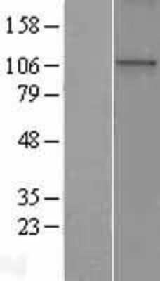 Western Blot: WDR36 Overexpression Lysate (Adult Normal) [NBP2-05576] Left-Empty vector transfected control cell lysate (HEK293 cell lysate); Right -Over-expression Lysate for WDR36.