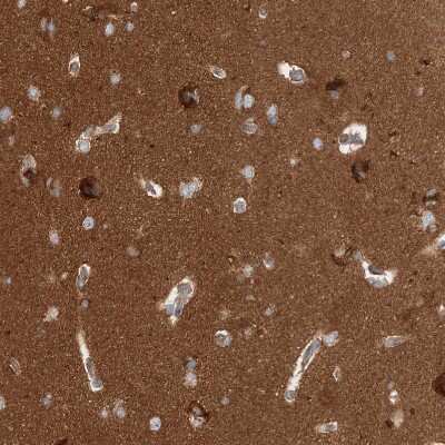 Immunohistochemistry-Paraffin: WDR37 Antibody [NBP1-81449] - Staining of human cerebral cortex shows strong positivity in neuropil.