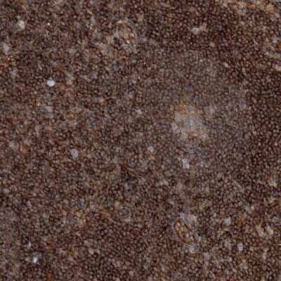 Immunohistochemistry-Paraffin: WDR37 Antibody [NBP1-81449] - Staining of human lymph node shows strong cytoplasmic positivity in non-germinal center cells.