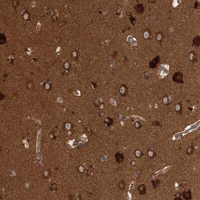 Immunohistochemistry-Paraffin: WDR37 Antibody [NBP1-81450] - Staining of human cerebral cortex shows strong positivity in neuropil.
