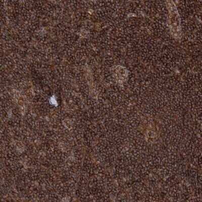 Immunohistochemistry-Paraffin: WDR37 Antibody [NBP1-81450] - Staining of human lymph node shows strong cytoplasmic positivity in non-germinal center cells.