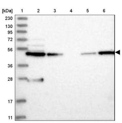 Western Blot: WDR37 Antibody [NBP1-81450] - Lane 1: Marker  [kDa] 230, 130, 95, 72, 56, 36, 28, 17, 11.  Lane 2: Human cell line RT-4.  Lane 3: Human cell line U-251MG sp.  Lane 4: Human plasma (IgG/HSA depleted).  Lane 5: Human liver tissue.  Lane 6: Human tonsil tissue