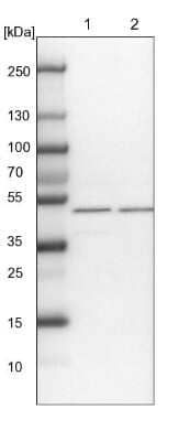 <b>Independent Antibodies Validation. </b>Western Blot: WDR37 Antibody [NBP1-81450] - Lane 1: NIH-3T3 cell lysate (Mouse embryonic fibroblast cells). Lane 2: NBT-II cell lysate (Rat Wistar bladder tumor cells).