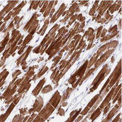 Immunohistochemistry: WDR38 Antibody [NBP2-30958] - Staining of human heart muscle shows strong cytoplasmic positivity in myocytes.