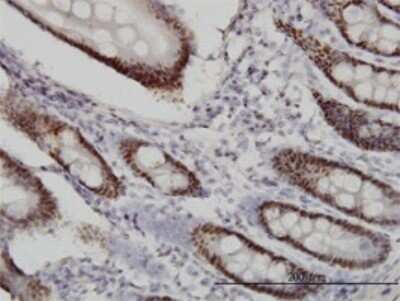 Immunohistochemistry-Paraffin: WDR4 Antibody (1F9) [H00010785-M01] - Analysis of monoclonal antibody to WDR4 on formalin-fixed paraffin-embedded human small Intestine. Antibody concentration 1 ug/ml.