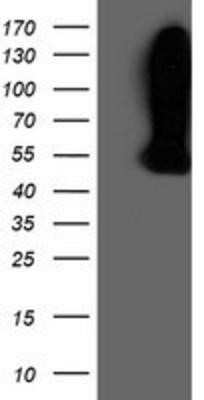 Western Blot: WDR4 Antibody (OTI4G1) - Azide and BSA Free [NBP2-74865] - HEK293T cells were transfected with the pCMV6-ENTRY control (Left lane) or pCMV6-ENTRY WDR4 (Right lane) cDNA for 48 hrs and lysed. Equivalent amounts of cell lysates (5 ug per lane) were separated by SDS-PAGE and immunoblotted with anti-WDR4.