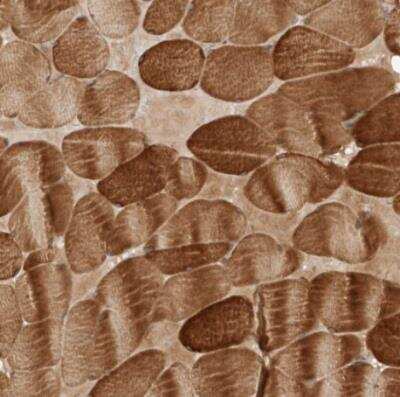 Immunohistochemistry-Paraffin: WDR42A Antibody [NBP1-92582] - Staining of human skeletal muscle shows strong cytoplasmic and membranous positivity in myocytes.