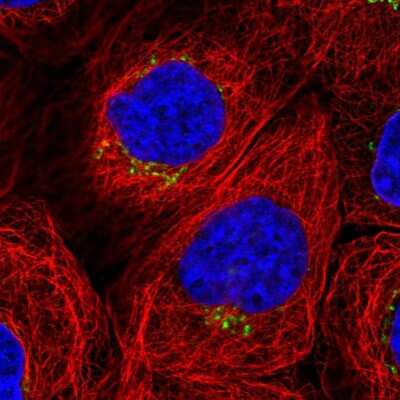 Immunocytochemistry/Immunofluorescence: WDR44 Antibody [NBP2-56672] - Staining of human cell line A-431 shows localization to the Golgi apparatus.