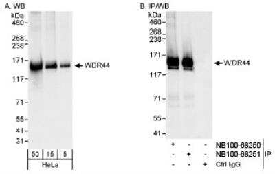 <b>Independent Antibodies Validation. </b>Western Blot: WDR44 Antibody [NB100-68250] - Detection of Human WDR44 on HeLa whole cell lysate using NB100-68250. WDR44 was also immunoprecipitated by rabbit anti-WDR44 antibody NB100-68251.