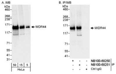 Western Blot: WDR44 Antibody [NB100-68251] - Detection of Human WDR44 on HeLa whole cell lysate using NB100-68251. WDR44 was also immunoprecipitated by rabbit anti-WDR44 antibody NB100-68250.