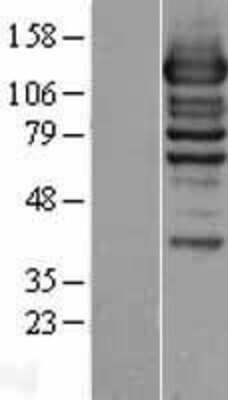 Western Blot: WDR44 Overexpression Lysate (Adult Normal) [NBL1-17809] Left-Empty vector transfected control cell lysate (HEK293 cell lysate); Right -Over-expression Lysate for WDR44.