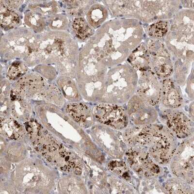 Immunohistochemistry-Paraffin WDR47 Antibody