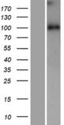 Western Blot: WDR47 Overexpression Lysate (Adult Normal) [NBP2-07233] Left-Empty vector transfected control cell lysate (HEK293 cell lysate); Right -Over-expression Lysate for WDR47.