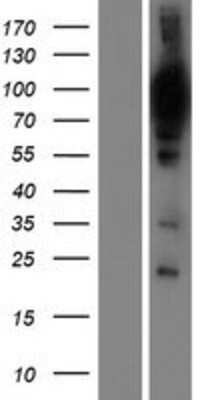 Western Blot: WDR48 Overexpression Lysate (Adult Normal) [NBP2-06599] Left-Empty vector transfected control cell lysate (HEK293 cell lysate); Right -Over-expression Lysate for WDR48.