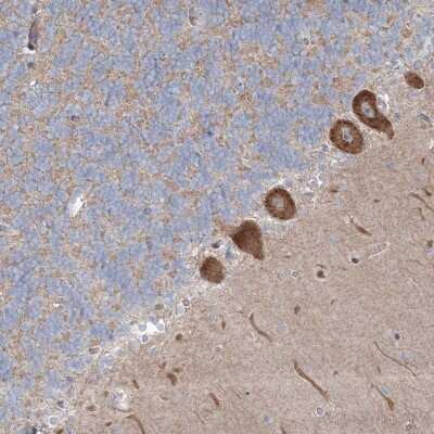 Immunohistochemistry WDR49 Antibody - BSA Free
