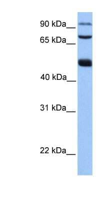 Western Blot: WDR49 Antibody [NBP1-70745] - Hela cell lysate, concentration 0.2-1 ug/ml.