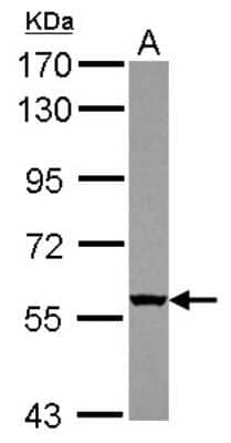 Western Blot: WDR49 Antibody [NBP2-20894] - Sample (30 ug of whole cell lysate) A: U87-MG 7. 5% SDS PAGE gel, diluted at 1:1000.